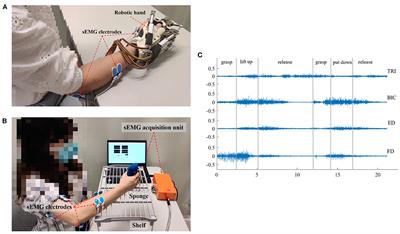 A Data-Driven Investigation on Surface Electromyography Based Clinical Assessment in Chronic Stroke